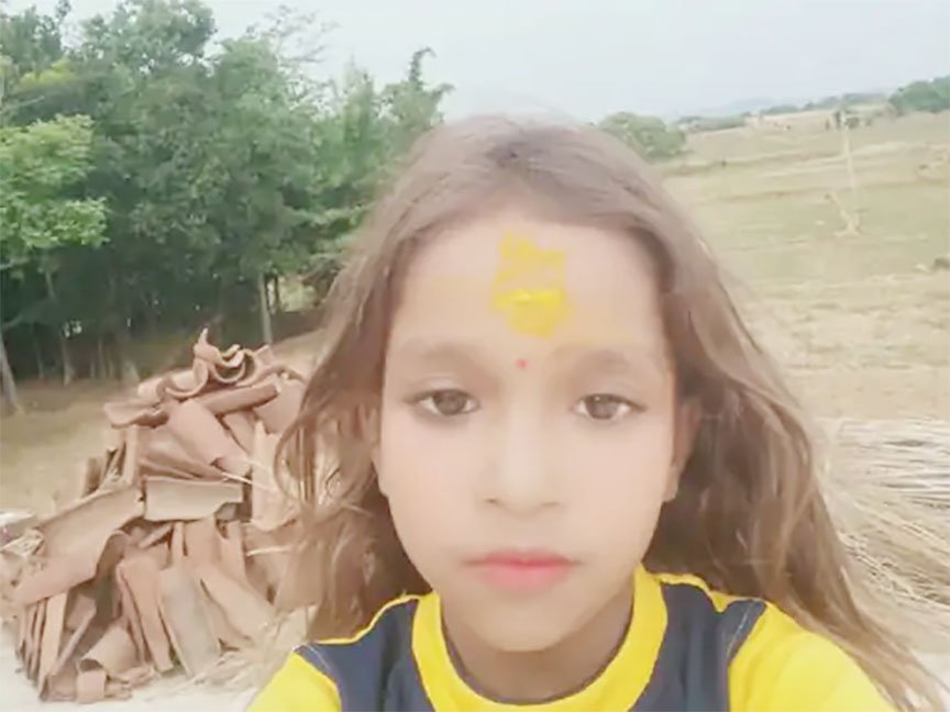सर्पदंश