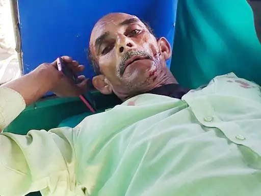 पटना में ट्रेन हादसे में व्यक्ति घायल